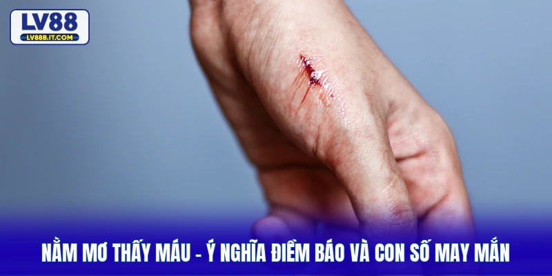 Nằm Mơ Thấy Máu - Ý Nghĩa Điềm Báo Và Con Số May Mắn 